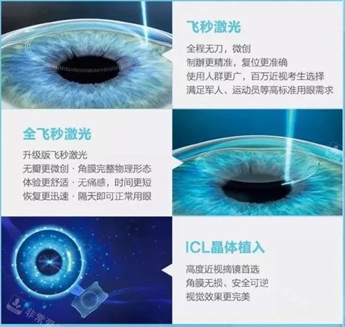 不同近视手术的区别