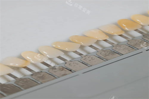 牙齿色差对比