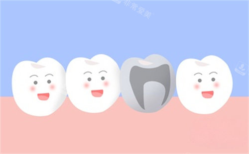 牙齿治疗卡通图片展示