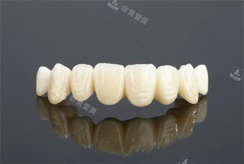 国产美加全瓷牙