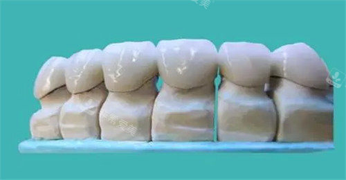 牙齿修复模型图