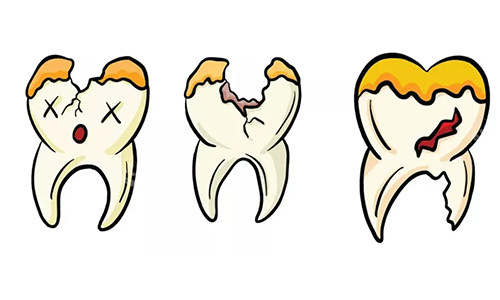 牙齿坏了一半动画图