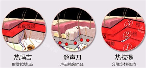 明洞DR.DESIGNER皮肤科怎么样?位于明洞三街446楼，特色项目与优质服务等你了解！