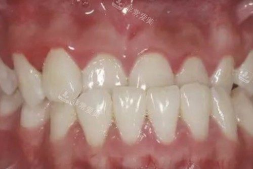 牙齿地包天卡通图