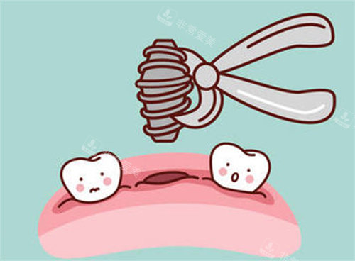 牙齿种植卡通图