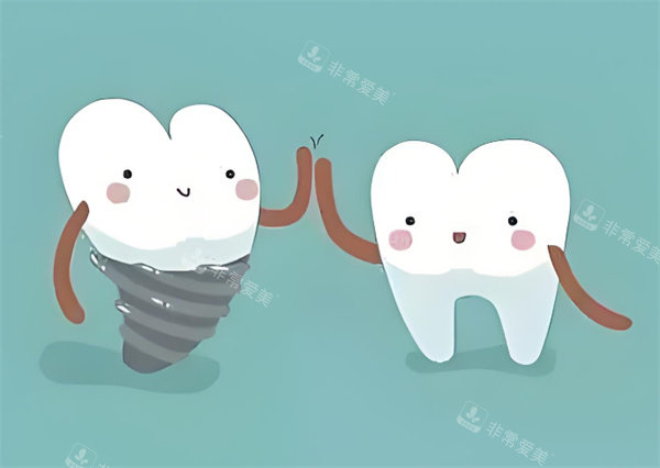 牙齿种植卡通图展示