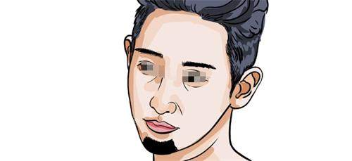 胡须种植卡通示意图