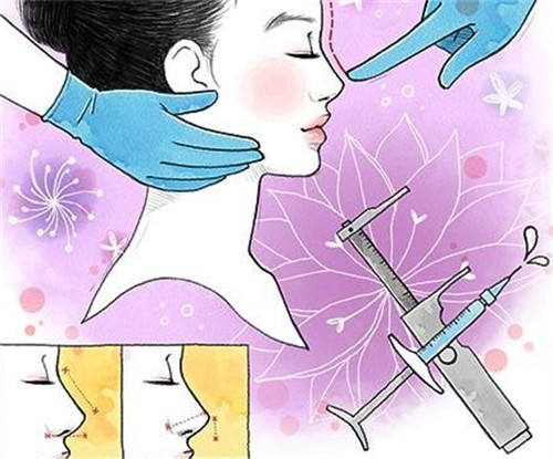 微晶瓷注射隆鼻前后对比