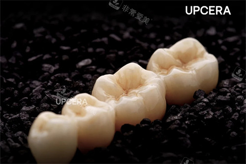 爱尔创-瓷倍健全瓷牙