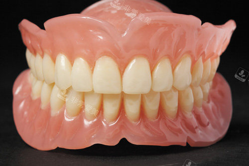 吸附性义齿模型图