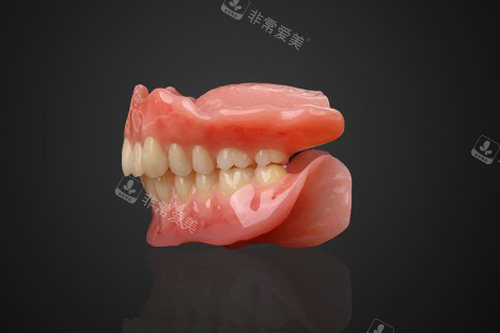 全口吸附性义齿侧面图