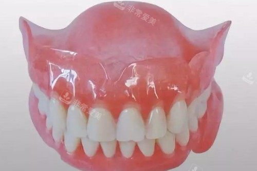 吸附于义齿卡通模型图