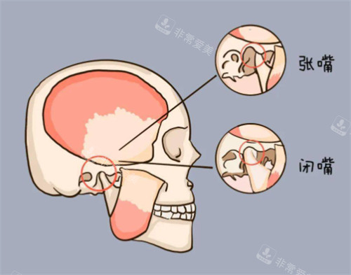 颞下颌关节紊乱会疼的位置