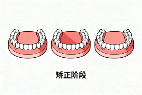 牙齿矫正成果展示