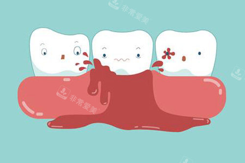 牙齿出血示意图