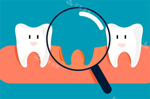 牙齿脱落卡通图片