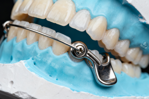 牙齿安装保持器展示图