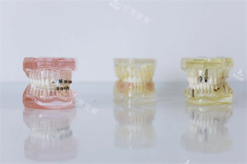 牙齿材料模型