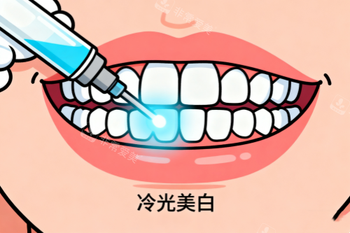 牙齿冷光美白卡通图