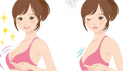 隆胸手术前后对比卡通图