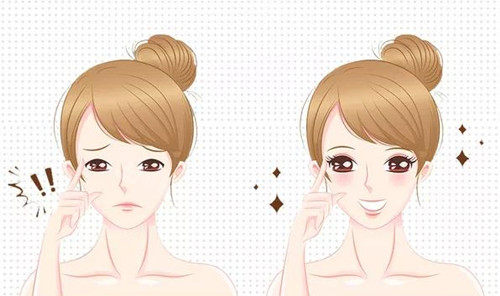 双眼皮术宣传图 双眼皮术宣传图