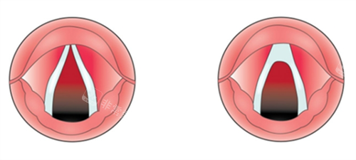 嗓子素材 嗓子素材