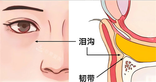 泪沟填充卡通图