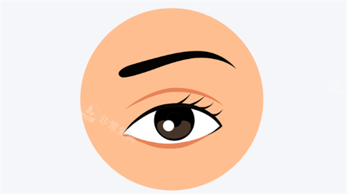 韩国双眼皮改单眼皮救我于失败！松解粘连+组织复位，闭眼疤痕隐形，记录我的妈生感逆袭