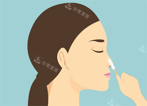 隆鼻整形手术卡通图