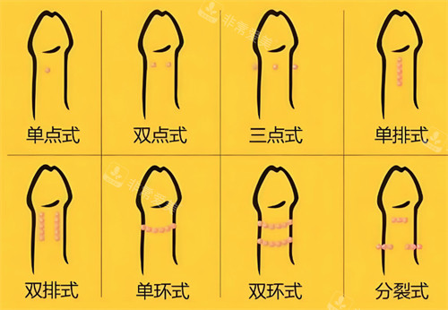 入珠的不同形式