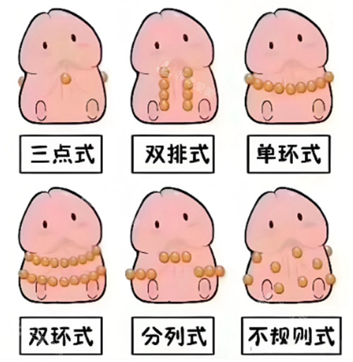 入珠的不同方式 入珠的不同方式