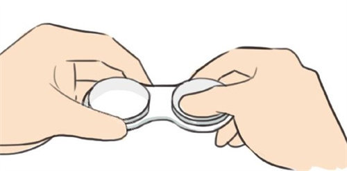 佩戴OK镜