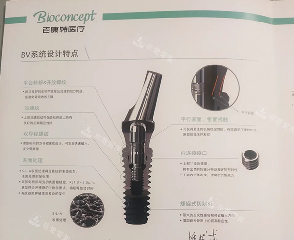 百康特种植牙好不好