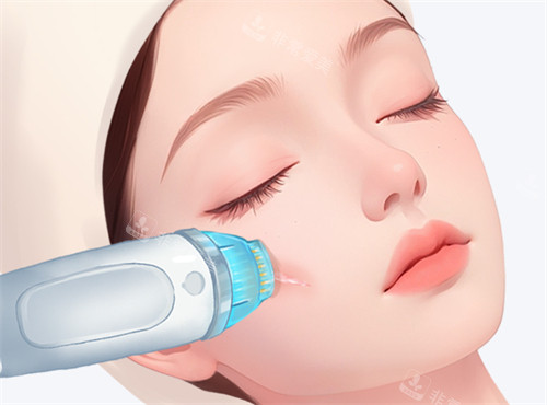 激光去疤有用吗