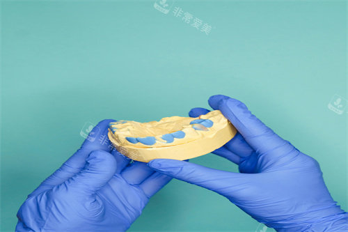 牙齿模型制作展示