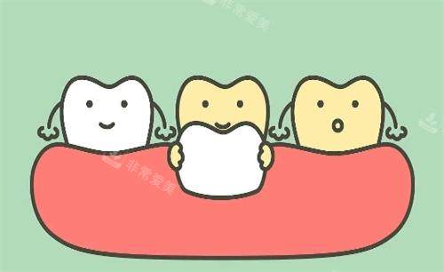 瓷贴面美白牙齿动画展示图