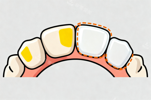 牙齿美白修复卡通图