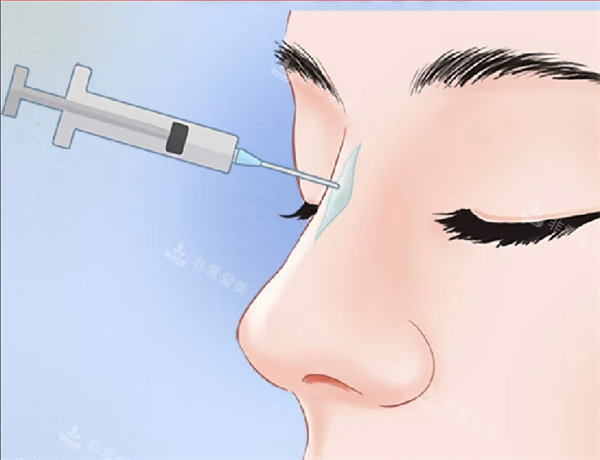 釜山Yemian皮肤科怎么样？皮肤管理做得好，玻尿酸注射技术不错~