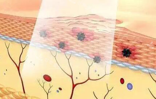 釜山Yemian皮肤科靠谱...