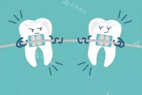 牙齿矫正卡通图