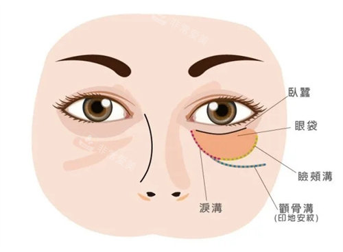 眼袋位置卡通图片