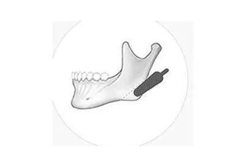 刷到北京何照华磨骨实...