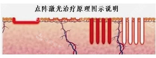 韩国做疤痕修复可靠医院介绍！含Dr.ham's医院、安成烈整形、清潭珠颜三家靠谱疤痕医院介绍！