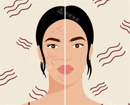 敏感肌治疗前后对比