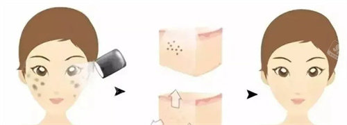 广州冰芙医疗美容地址在哪里？海珠区琶洲蟠龙新街2号3层是详细地址哦！