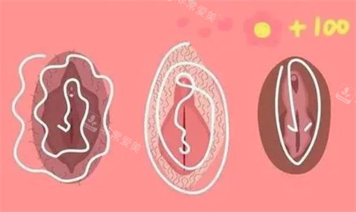 私密漂红卡通图