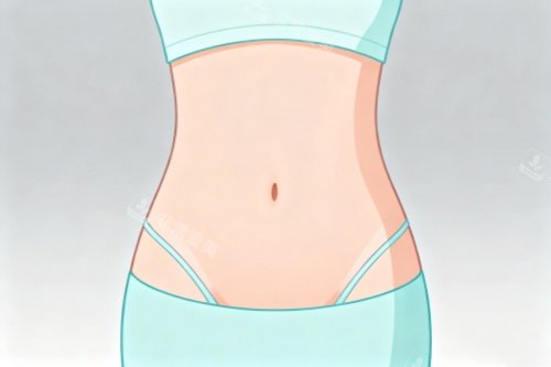 腰腹部做吸脂塑形卡通图