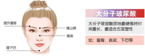 大分子玻尿酸简介