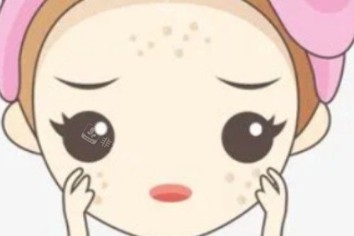 脸上长斑卡通图