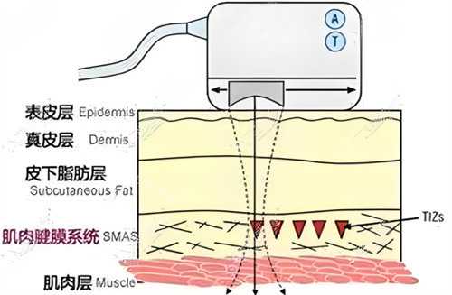 首尔江南区皮肤科哪家好?韩国布利亚/新英/本思莫佳诺哪家强？项目特色全知晓